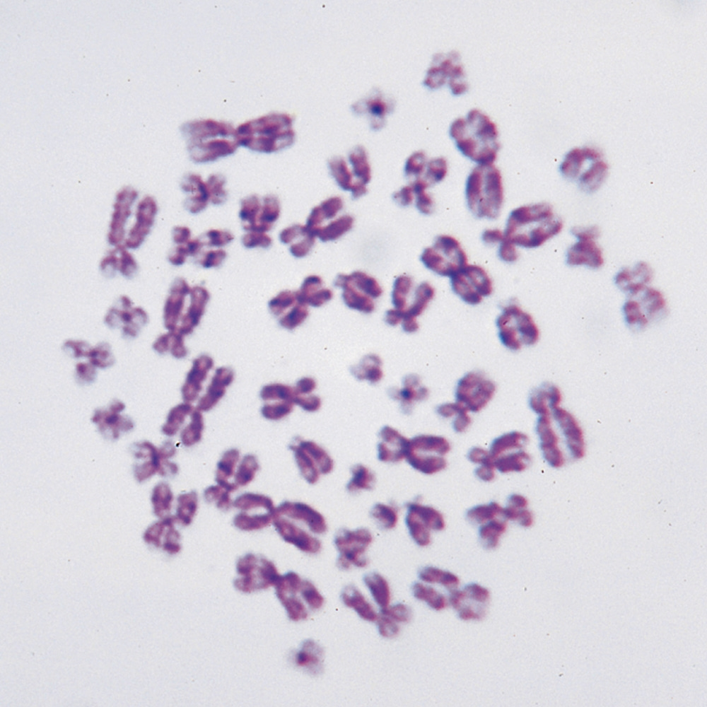 사람염색체 프레파라트 인간 현미경표본 온핸드90
