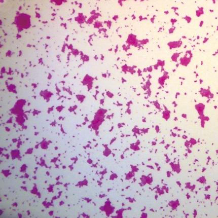 포도상구균 프레파라트 미생물 현미경표본 온핸드90