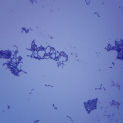 폐렴균 프레파라트 미생물 현미경표본 온핸드90