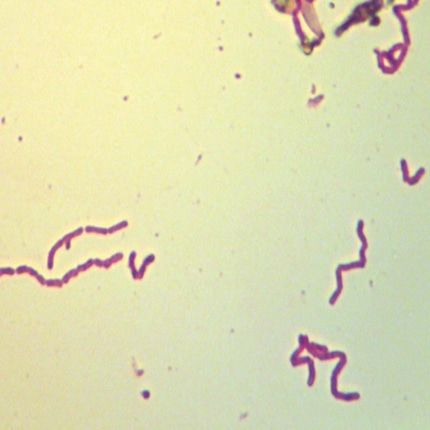 헬리코박터균 프레파라트 미생물 현미경표본 온핸드90