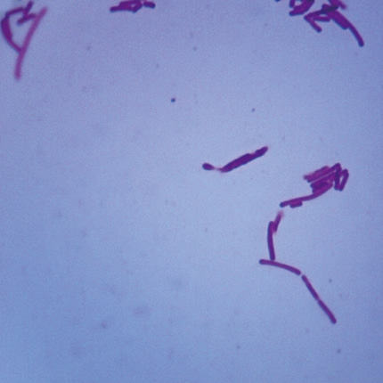 유산균 프레파라트 미생물 현미경표본 온핸드90