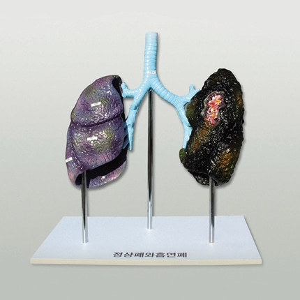 폐의 비교 정상폐와 흡연폐. 금연교육 과학 온핸드90