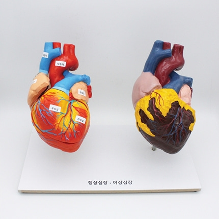 정상심장과 이상심장. 심장구조 생물과학 온핸드90